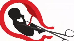 Kürtaj Operasyonu Nedir?